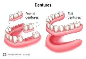 Complete Dentures Explained: Benefits, Fit, and Care Tips